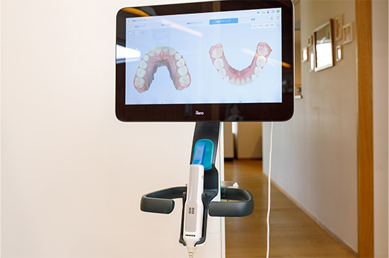 矯正用口腔内スキャナー （iTero エレメント 5Dプラス）